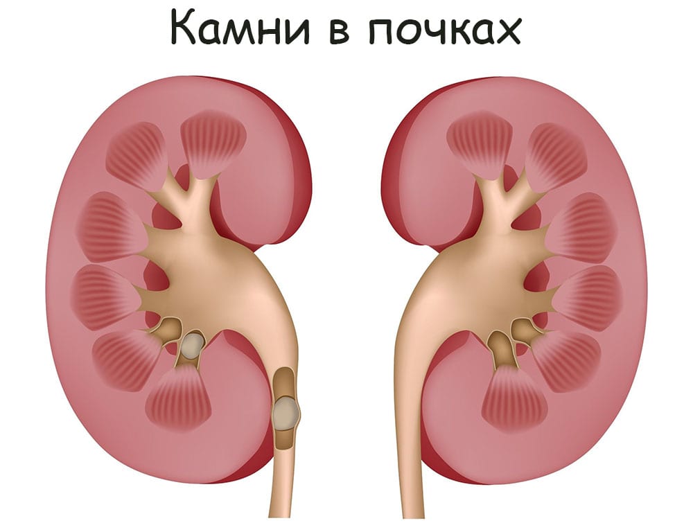 Kra18.at